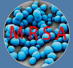 MRSA - стафилококк устойчивый к метициллину