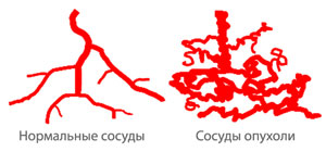 Нормальные сосуды и сосуды опухоли